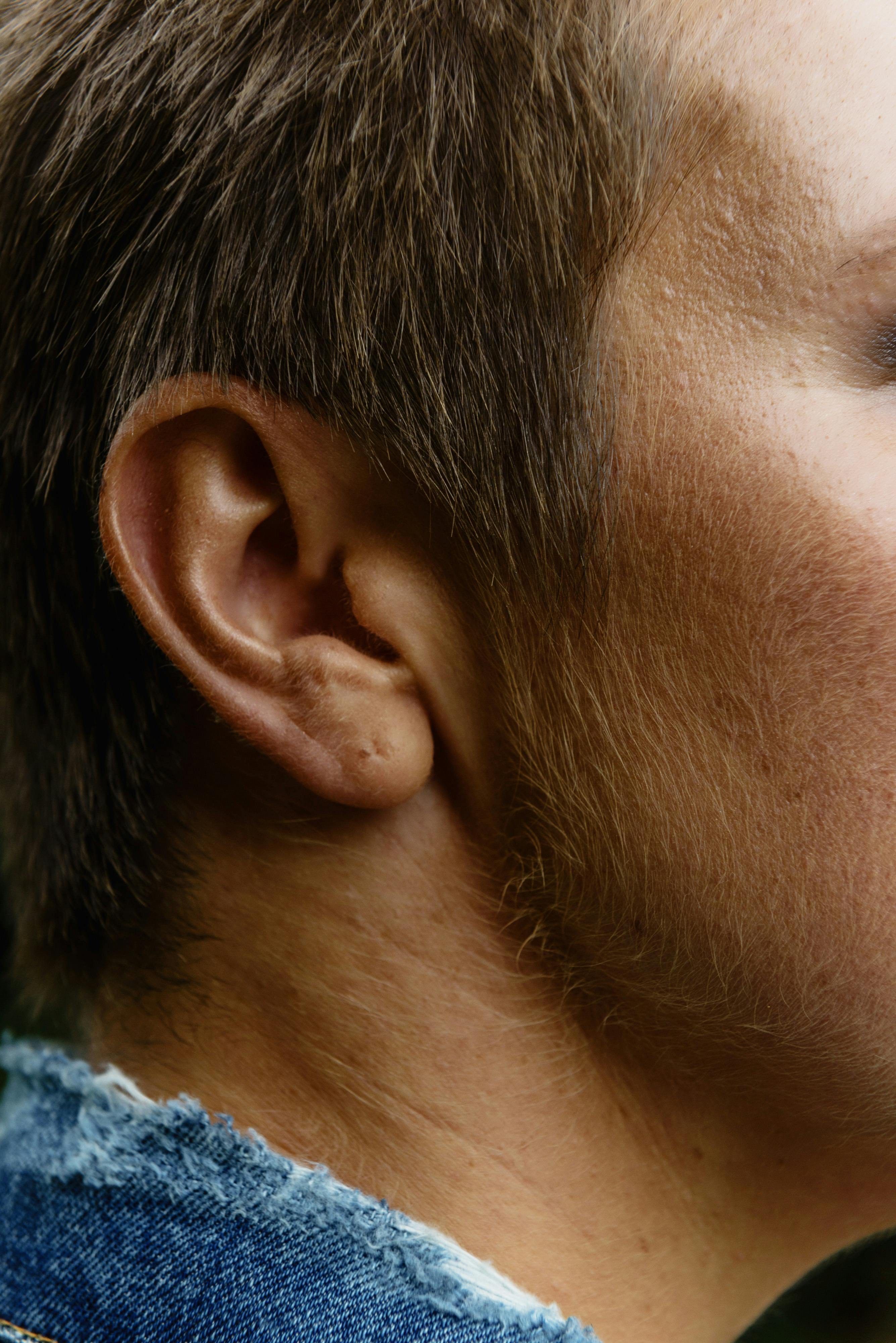 Effective Ways to Treat High Testosterone in Women Naturally